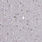 Immunohistochemical staining of human Cerebral cortex shows moderate granular cytoplasmic positivity in neuronal cells.