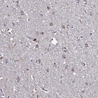 Immunohistochemical staining of human Cerebral cortex shows moderate granular cytoplasmic positivity in neuronal cells.