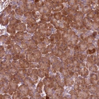 Anti-ENKD1 Antibody