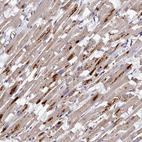 Immunohistochemical staining of human heart muscle shows moderate granular cytoplasmic positivity in cardiomyocytes.