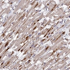Immunohistochemical staining of human heart muscle shows moderate granular cytoplasmic positivity in cardiomyocytes.