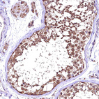 Immunohistochemical staining of human testis shows strong cytoplasmic positivity in cells in seminiferous ducts.