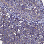 Immunohistochemical staining of human Tonsil shows very weak granular cytoplasmic positivity in non-germinal center cells.