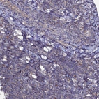 Immunohistochemical staining of human Tonsil shows very weak granular cytoplasmic positivity in non-germinal center cells.