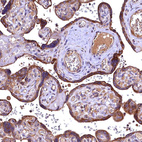 Immunohistochemical staining of human placenta shows strong cytoplasmic positivity in trophoblastic cells.