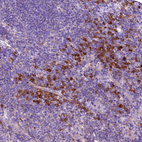 Immunohistochemical staining of human tonsil shows strong cytoplasmic positivity in non-germinal center cells.