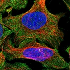 Immunofluorescent staining of human cell line U-2 OS shows localization to plasma membrane & centrosome.