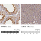 Anti-KATNB1 Antibody