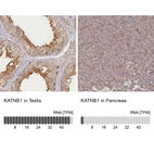 Anti-KATNB1 Antibody