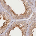 Immunohistochemical staining of human testis shows high expression.