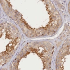Immunohistochemical staining of human testis shows high expression.