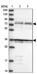 Lane 1: Marker [kDa] 250, 130, 95, 72, 55, 36, 28, 17, 10_br/_Lane 2: Human cell line RT-4_br/_Lane 3: Human cell line U-251MG sp