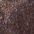 Anti-EDC4 Antibody