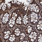 Immunohistochemical staining of human Colon shows strong cytoplasmic positivity in glandular cells.