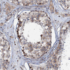 Immunohistochemical staining of human Testis shows moderate cytoplasmic positivity in spermatogonia and Leydig cells.