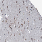 Immunohistochemical staining of human Cerebral cortex shows moderate cytoplasmic positivity in neuronal cells.