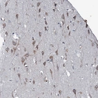 Immunohistochemical staining of human Cerebral cortex shows moderate cytoplasmic positivity in neuronal cells.