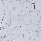 Immunohistochemical staining of human Skeletal muscle shows very weak cytoplasmic positivity in myocytes.