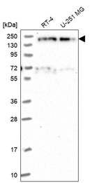 Western blot analysis in human cell line RT-4 and human cell line U-251 MG.
