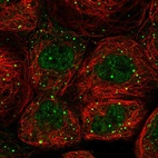 Immunofluorescent staining of human cell line A-431 shows localization to nucleoplasm & cytoplasmic bodies.