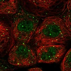 Immunofluorescent staining of human cell line A-431 shows localization to nucleoplasm & cytoplasmic bodies.