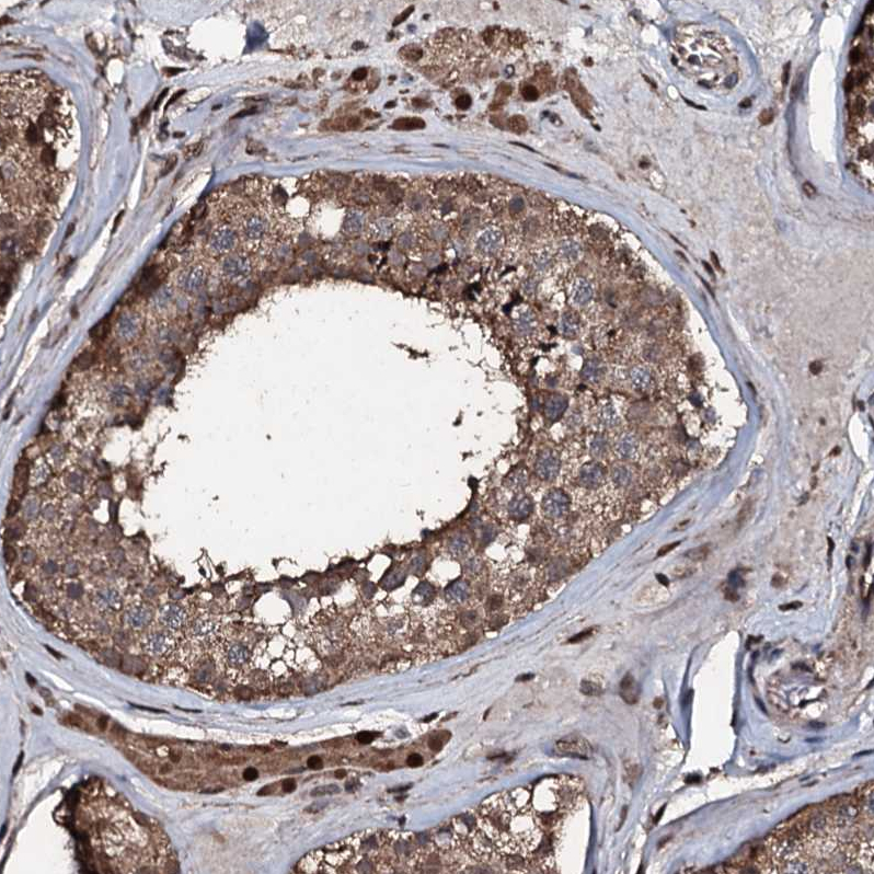 Anti-FAAP24 Antibody