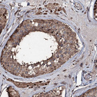 Anti-FAAP24 Antibody