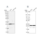 Western blot analysis using Anti-PGRMC2 antibody HPA041172 (A) shows similar pattern to independent antibody HPA058652 (B).