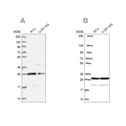 Western blot analysis using Anti-PGRMC2 antibody HPA041172 (A) shows similar pattern to independent antibody HPA058652 (B).