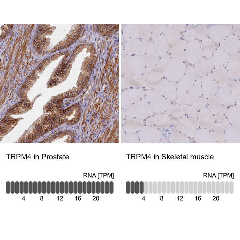 Anti-TRPM4 Antibody