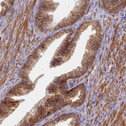 Immunohistochemical staining of human prostate shows strong membranous positivity in glandular cells and smooth muscle cells.