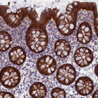 Immunohistochemical staining of human colon shows strong membranous positivity in glandular cells.