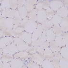 Immunohistochemical staining of human skeletal muscle shows no positivity in myocytes as expected.