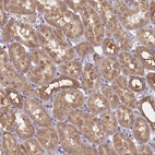 Anti-TIMM8B Antibody