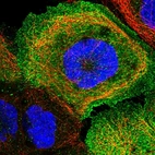 Immunofluorescent staining of human cell line A-431 shows localization to plasma membrane & cytosol.