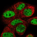 Immunofluorescent staining of human cell line A-431 shows localization to nucleoplasm.