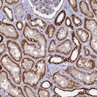 Anti-MPV17L Antibody