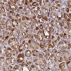 Immunohistochemical staining of human stomach shows cytoplasmic positivity in glandular cells.