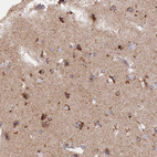 Immunohistochemical staining of human cerebral cortex shows cytoplasmic positivity in neurons.