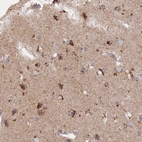 Immunohistochemical staining of human cerebral cortex shows cytoplasmic positivity in neurons.