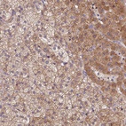 Anti-SPATA2L Antibody