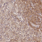 Anti-SPATA2L Antibody