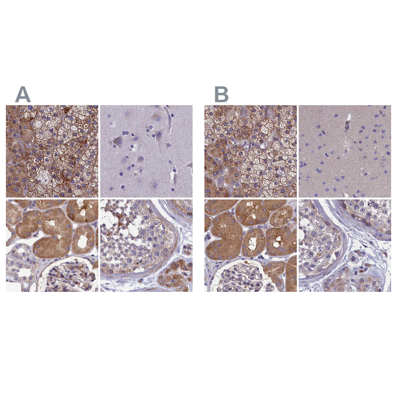 Anti-AMDHD2 Antibody