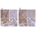 Anti-AMDHD2 Antibody