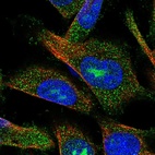Immunofluorescent staining of human cell line U-251 MG shows localization to nucleoli & cytosol.