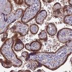 Anti-DNAJC17 Antibody