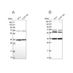Western blot analysis using Anti-DNAJC17 antibody HPA041187 (A) shows similar pattern to independent antibody HPA040914 (B).