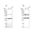 Western blot analysis using Anti-DNAJC17 antibody HPA041187 (A) shows similar pattern to independent antibody HPA040914 (B).