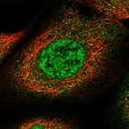 Immunofluorescent staining of human cell line A-431 shows localization to nucleoplasm & cytosol.