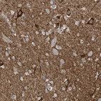 Anti-WIPF3 Antibody